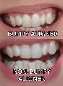 Aligner Comparison