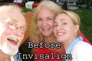 Before Invisalign
